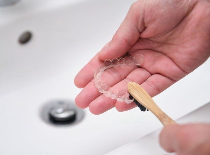 How to Clean and Maintain Clear Aligners Properly: A Step-by-Step Guide